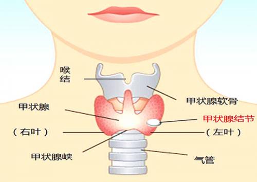 太乙堂马健：治疗甲状腺结节，宜从肝脾入手