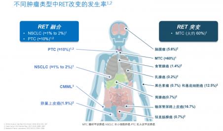 两个月咳出肿瘤组织，高响应率非小细胞肺癌靶向药将改变患者命运