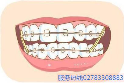 昆明隐形牙齿矫正哪家好？昆明德韩口腔如何