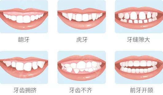 烟台牙齿矫正哪家医院好？德韩口腔矫正技术如何？