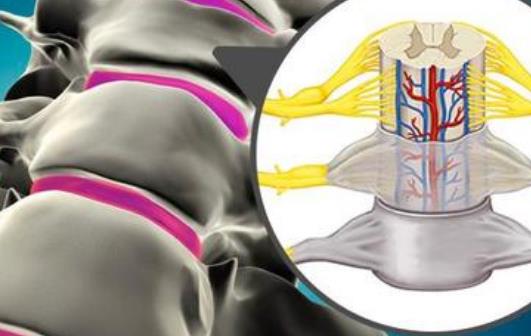 急性脊髓炎患者可以这样做，急性脊髓炎的治疗方法