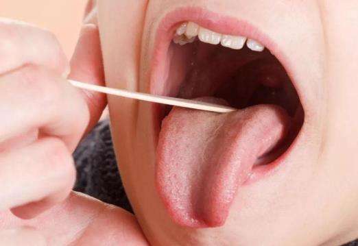 舌苔又白又厚是咋回事？舌苔厚白湿气重怎么办？