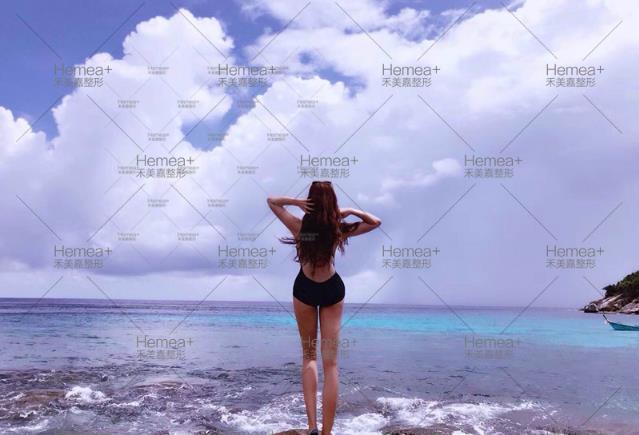 大腿吸脂整体美感重要吗？禾美嘉关几梦给出答案