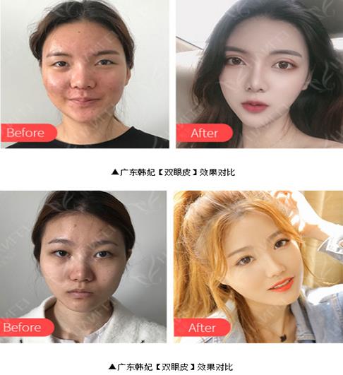 广东韩妃于洪瑞主任如何 全国上榜绿宝石专家团之一