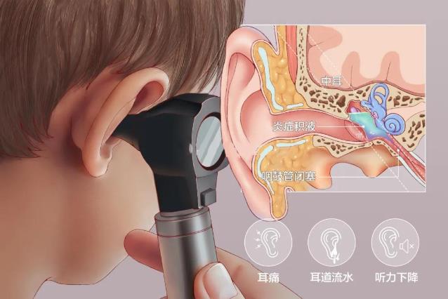成都民生耳鼻喉医院提醒：除了小心中耳炎，更要警惕中耳癌！