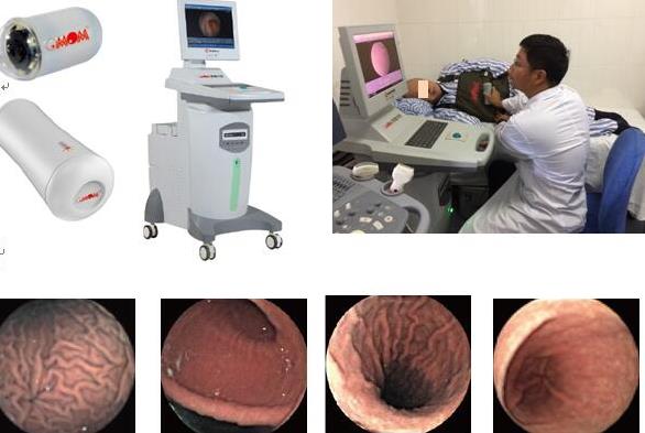 什么？做胃镜检查竟不用插管？揭秘南宁东大智能磁控胶囊胃镜系统