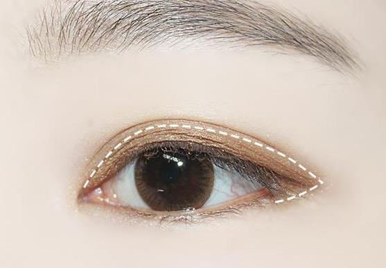 眼睑上为什么会长脂肪粒？眼睛流泪不止是什么原因？