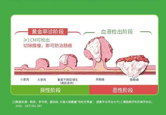 长安心粪便基因检测，助力肠癌精准防控