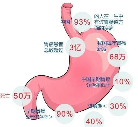 无症状被查出了胃癌……很多悲剧几乎每天在消化内镜中心上演！