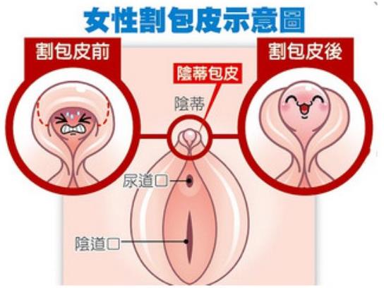 贵阳丽都私密整形医院：带你找回敏感性福生活