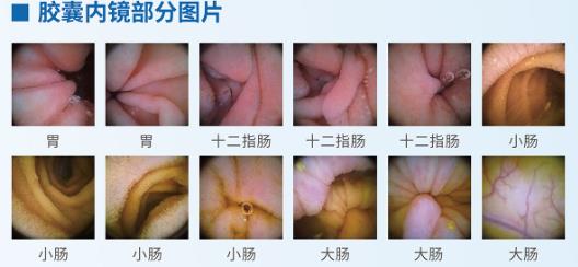 呼市东大肛肠医院 只要做到一件事，胃癌将是少见癌症