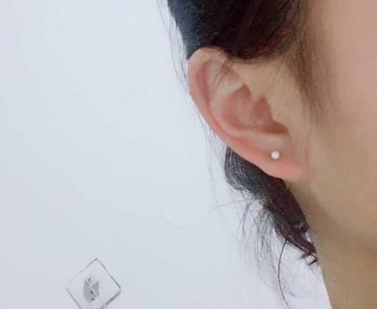 刚打耳洞带什么耳钉好？耳洞戴塑料棒会发炎过敏吗？