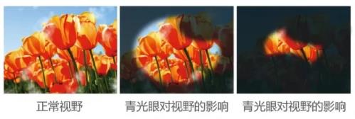 因青光眼备受煎熬，兰州爱尔眼科还患者健康视界