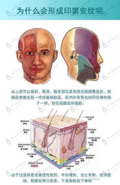 伊站医美抗衰护理 印第安纹是哪个部位