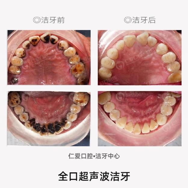 武汉仁爱口腔：保持口腔健康，让生活更美好！