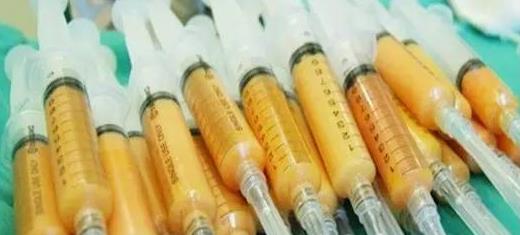 北京刘靖涛院长做腰腹吸脂效果好不好，平不平