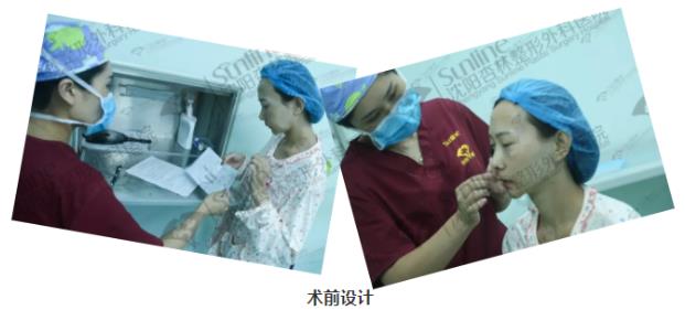 沈阳杏林整形外科医院自体脂肪面部填充费用