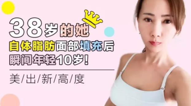 沈阳杏林整形外科医院自体脂肪面部填充费用