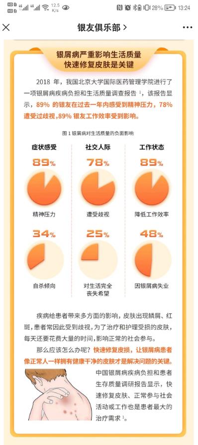 癣是怎么引起的？银屑病人怎么看待它？