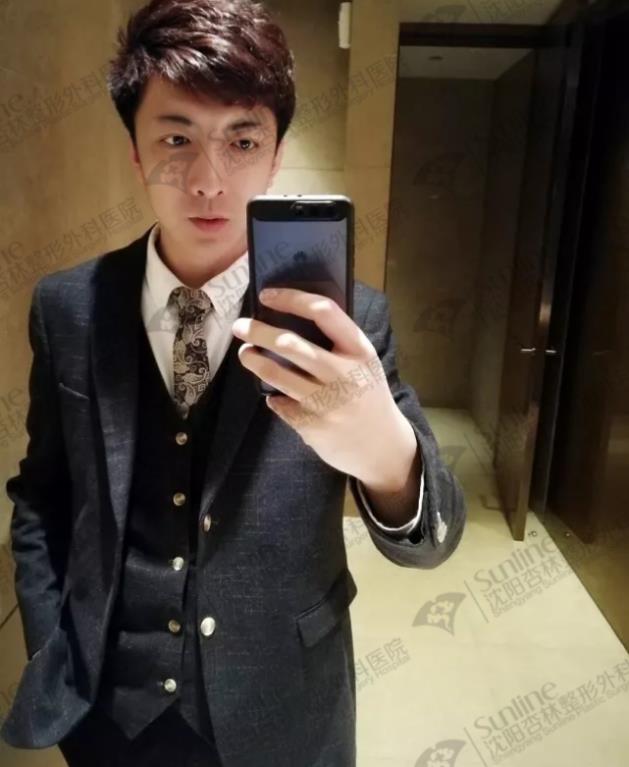 沈阳杏林整形外科医院：下颌后缩怎么办