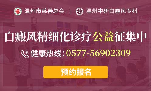 台州白癜风医院好不好？白斑容易发生在哪些部位