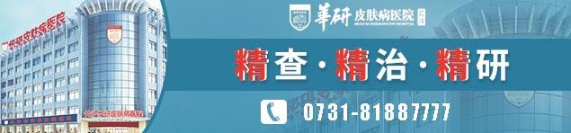 长沙华研皮肤病医院白癜风科怎么样
