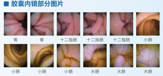 呼市东大肛肠医院 出现这7个征兆，要警惕胃癌！