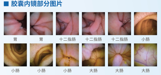 呼和浩特市东大肛肠医院 胃不好怎么保养？这几个细节需要注意