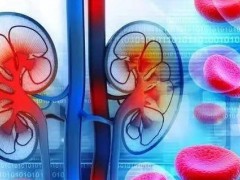 尿毒症肺炎有哪些症状？尿毒症肺炎做哪些检查？