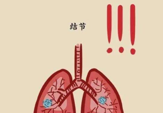 体检时查出肺部结节会有危险吗？肺结节会一辈子没事吗
