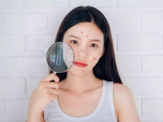 打完宫颈癌疫苗后脸上冒痘正常吗？刚挤了痘痘能打疫苗吗