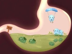 胃胀气是怎么回事？胃胀气吃什么好
