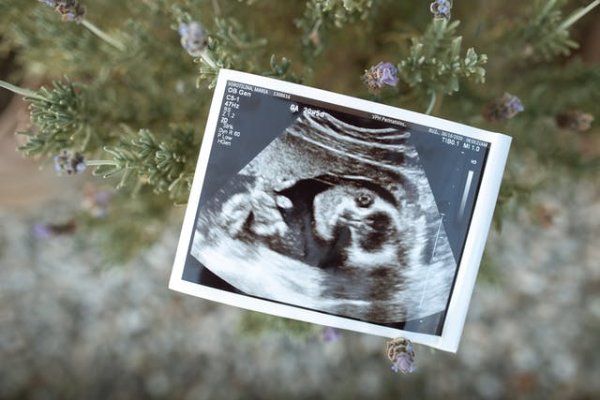 孕妇小腿抽筋自救办法