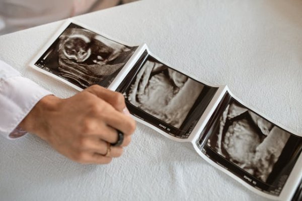孕妇吃红毛丹会上火吗
