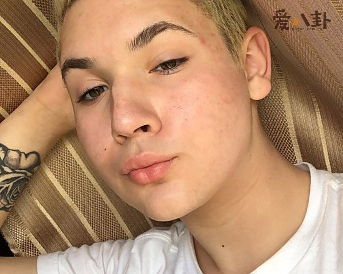 小说雌雄同体的人真的存在吗 美国18岁男孩已成功怀孕