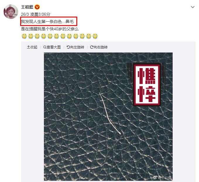 出现白鼻毛是什么原因？鼻子里长白鼻毛是有福气吗