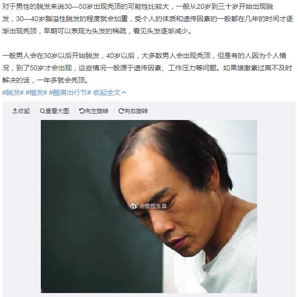 女人眼里秃顶男人是什么感觉,男人秃顶有福气吗?