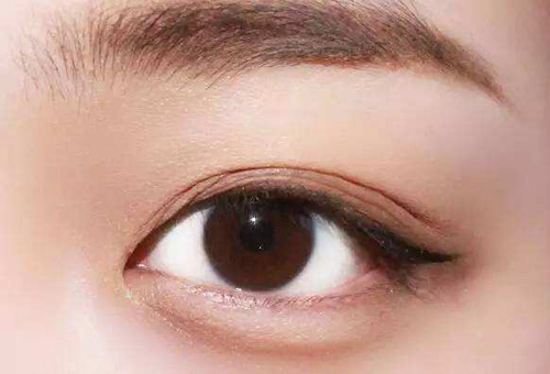 怎么区分卧蚕和眼袋？这3点别傻傻分不清！