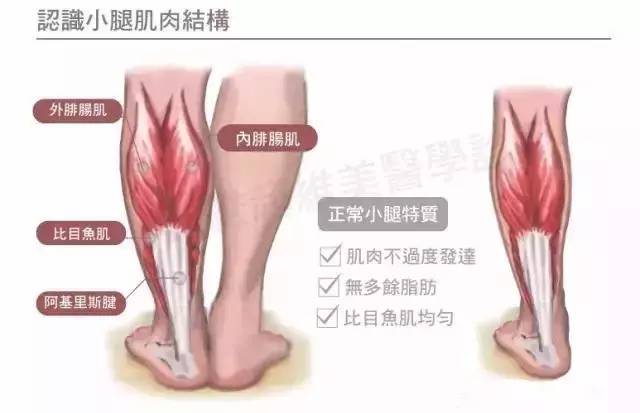 小腿上是脂肪还是肌肉分清了吗？瘦腿方法收起来！