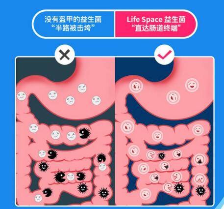 孕妇益生菌虽作用大，但孕妇在这些情况吃才更好