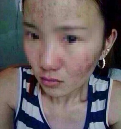 三大补水误区水嫩毁容一线之间