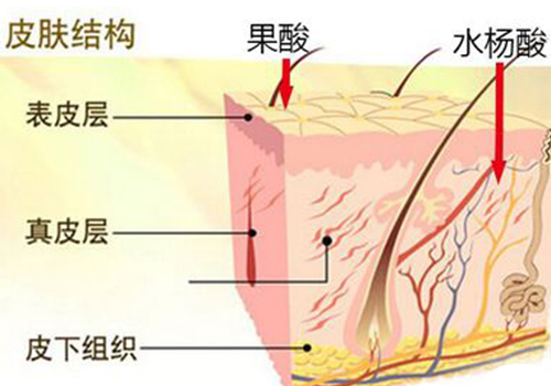 刷酸会导致敏感肌肤嘛 刷酸后能见光吗