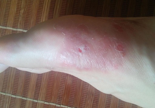 女孩的第1次月经注意事项