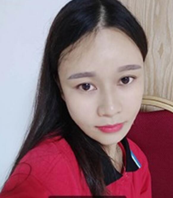 灵旋笔记：眼袋过重，就会显得比真实年龄大，要如何修复眼袋呢?