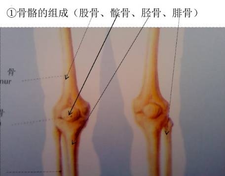 大部分膝盖疼痛与髌骨外移密切相关