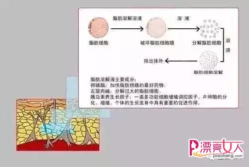 瘦脸针和溶脂针哪个好 溶脂针和瘦脸针的区别