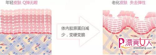 隆鼻有后遗症吗 隆过鼻子老了之后会怎样