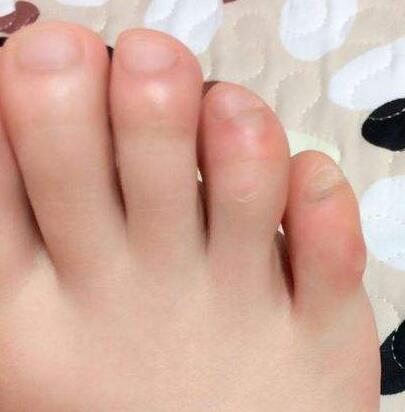 9种天然花草排毒又美体
