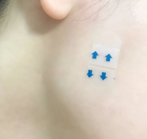 瘦脸贴的使用方法 有副作用吗