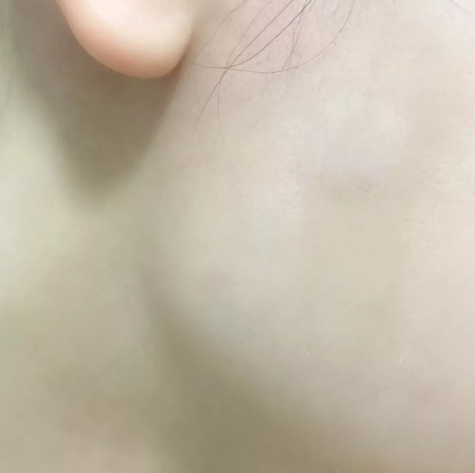 瘦脸贴的使用方法 有副作用吗